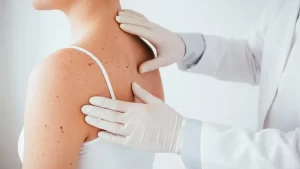 Most Common Treatment for Skin Cancer