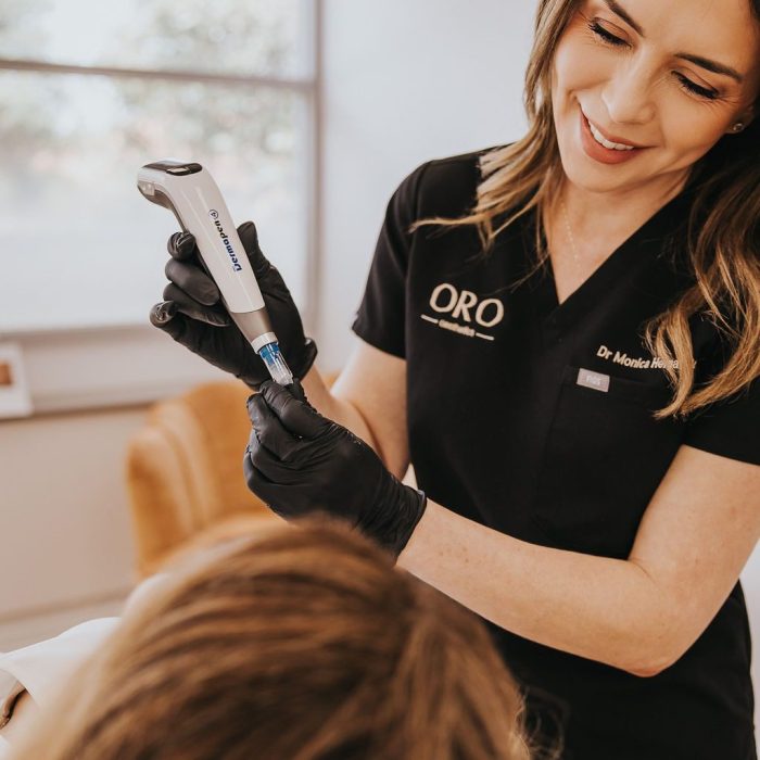microneedling